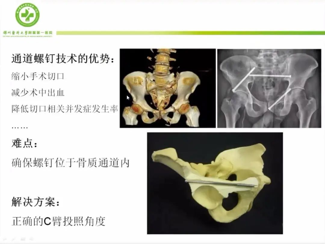 聚焦顯微外科|葫蘆島市醫(yī)學(xué)會(huì)顯微外科學(xué)分會(huì)第一屆第二次學(xué)術(shù)會(huì)議順利召開(kāi)(圖11)